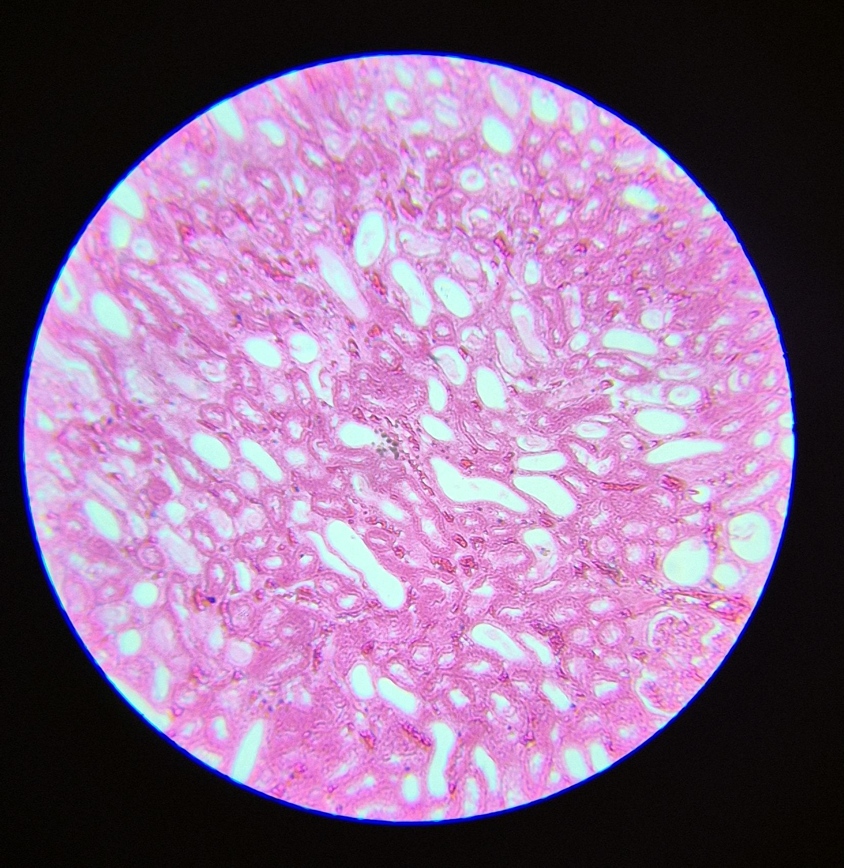 no-87-rein-l-s-kidney-of-l-s